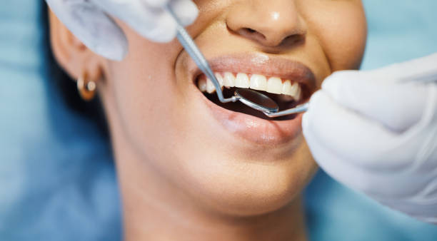 Best Broken or Chipped Tooth Repair in Minorca, LA