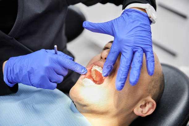 Best Lost Filling or Crown Replacement in Minorca, LA